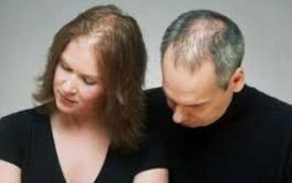 Chute de cheveux : comprendre les causes et découvrir les solutions efficaces